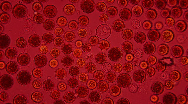 L'Astaxanthine